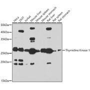 Western blot analysis of various lysates using Thymidine Kinase 1 Antibody at 1/1000 dilution. Secondary antibody: HRP-conjugated Goat anti-Rabbit IgG (H+L) at 1/10000 dilution. Lysates/proteins: 25 µg per lane. Blocking buffer: 3% nonfat dry milk in TBST. Exposure time: 180s.