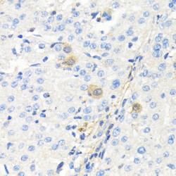 Thymidine Kinase, Cytosolic (TK1) Antibody