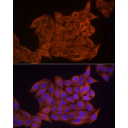 Thymidine Kinase, Cytosolic (TK1) Antibody