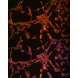 Thymidine Kinase, Cytosolic (TK1) Antibody