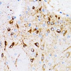 Membrane-Associated Progesterone Receptor Component 1 (PGRMC1) Antibody