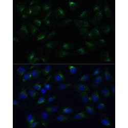 Membrane-Associated Progesterone Receptor Component 1 (PGRMC1) Antibody