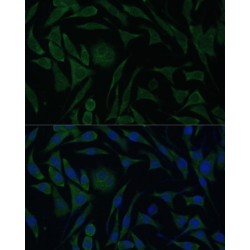 Membrane-Associated Progesterone Receptor Component 1 (PGRMC1) Antibody