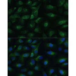 Membrane-Associated Progesterone Receptor Component 1 (PGRMC1) Antibody