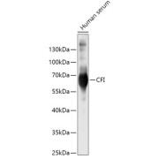 Western blot analysis of lysates from Human serum, using CFI Antibody at 1/500 dilution. Secondary antibody: HRP-conjugated Goat anti-Rabbit IgG (H+L) at 1/10000 dilution. Lysates/proteins: 25 µg per lane. Blocking buffer: 3% nonfat dry milk in TBST. Exposure time: 5s.
