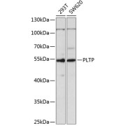 Western blot analysis of various lysates using PLTP Antibody at 1/1000 dilution. Secondary antibody: HRP-conjugated Goat anti-Rabbit IgG (H+L) at 1/10000 dilution. Lysates/proteins: 25 µg per lane. Blocking buffer: 3% nonfat dry milk in TBST. Exposure time: 90s.