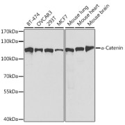 Western blot analysis of various lysates using [KO Validated] α-Catenin Antibody at 1/1000 dilution. Secondary antibody: HRP-conjugated Goat anti-Rabbit IgG (H+L) at 1/10000 dilution. Lysates/proteins: 25 µg per lane. Blocking buffer: 3% nonfat dry milk in TBST. Exposure time: 60s.