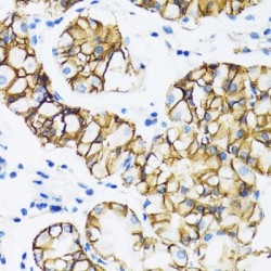 Catenin Alpha 1 (CTNNA1) Antibody