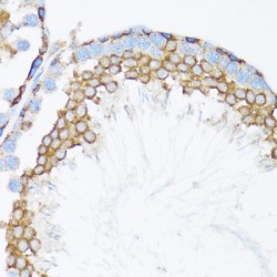 Catenin Alpha 1 (CTNNA1) Antibody