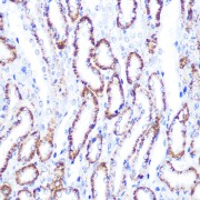 Western blot analysis of lysates from HCT116 cells, using Smad4 Antibody at 1/600 dilution. Secondary antibody: HRP-conjugated Goat anti-Rabbit IgG (H+L) at 1/10000 dilution. Lysates/proteins: 25 µg per lane. Blocking buffer: 3% nonfat dry milk in TBST. Exposure time: 30s.