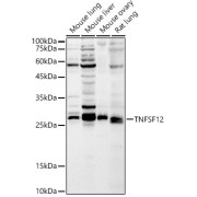 Western blot analysis of various lysates using TNFSF12 Antibody at 1/1000 dilution. Secondary antibody: HRP-conjugated Goat anti-Rabbit IgG (H+L) at 1/10000 dilution. Lysates/proteins: 25 µg per lane. Blocking buffer: 3% nonfat dry milk in TBST. Exposure time: 60s.