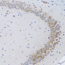 Tumor Necrosis Factor Ligand Superfamily Member 12 (TNFSF12) Antibody