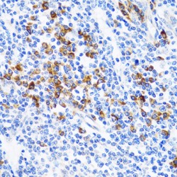 Tumor Necrosis Factor Ligand Superfamily Member 12 (TNFSF12) Antibody