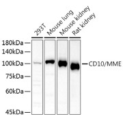 Western blot analysis of various lysates using CD10/MME Antibody at 1/500 dilution. Secondary antibody: HRP-conjugated Goat anti-Rabbit IgG (H+L) at 1/10000 dilution. Lysates/proteins: 25 µg per lane. Blocking buffer: 3% nonfat dry milk in TBST. Exposure time: 180s.