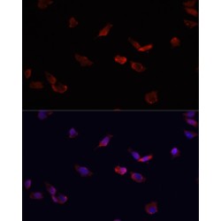 Bone Morphogenetic Protein Receptor 2 (BMPR2) Antibody