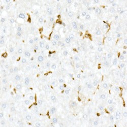 HLA Class II Histocompatibility Antigen Gamma Chain (CD74) Antibody
