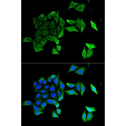 Ephrin B2 (EFNB2) Antibody