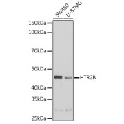 Western blot analysis of various lysates using HTR2B Antibody at 1/1000 dilution. Secondary antibody: HRP-conjugated Goat anti-Rabbit IgG (H+L) at 1/10000 dilution. Lysates/proteins: 25 µg per lane. Blocking buffer: 3% nonfat dry milk in TBST. Exposure time: 10s.