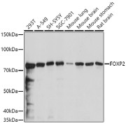 abx004342