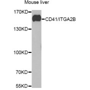 Western blot analysis of lysates from mouse liver, using CD41/ITGA2B Antibody at 1/1000 dilution. Secondary antibody: HRP-conjugated Goat anti-Rabbit IgG (H+L) at 1/10000 dilution. Lysates/proteins: 25 µg per lane. Blocking buffer: 3% nonfat dry milk in TBST. Exposure time: 30s.