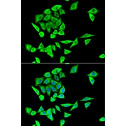 Growth Factor Receptor Bound Protein 2 (GRB2) Antibody