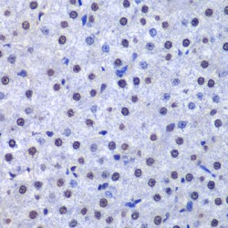 Glutathione S-Transferase P (GSTP1) Antibody