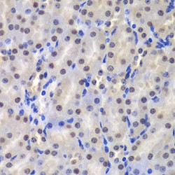 Glutathione S-Transferase P (GSTP1) Antibody
