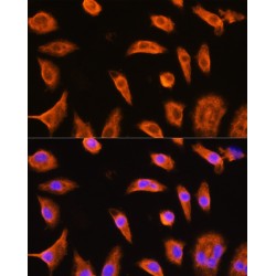 Glutathione S-Transferase P (GSTP1) Antibody