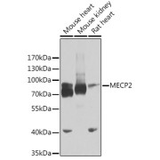 Western blot analysis of various lysates using MECP2 Antibody at 1/2000 dilution. Secondary antibody: HRP-conjugated Goat anti-Rabbit IgG (H+L) at 1/10000 dilution. Lysates / proteins: 25 µg per lane. Blocking buffer: 3 % nonfat dry milk in TBST. Detection: ECL Basic Kit (RM00020). Exposure time: 20s.