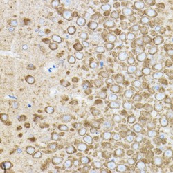 Rho-Associated Protein Kinase 2 (ROCK2) Antibody