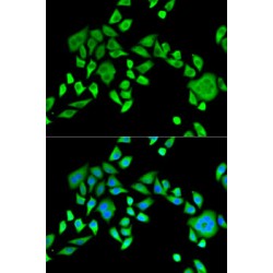 SH3 Domain Containing GRB2 Like 2, Endophilin A1 (SH3GL2) Antibody