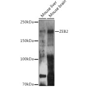 Western blot analysis of various lysates using ZEB2 Antibody at 1/500 dilution. Secondary antibody: HRP-conjugated Goat anti-Rabbit IgG (H+L) at 1/10000 dilution. Lysates/proteins: 25 µg per lane. Blocking buffer: 3% nonfat dry milk in TBST. Exposure time: 180s.