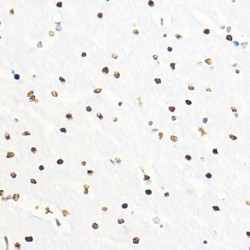 Zinc Finger E-Box-Binding Homeobox 2 (ZEB2) Antibody