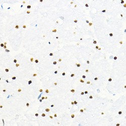Zinc Finger E-Box-Binding Homeobox 2 (ZEB2) Antibody