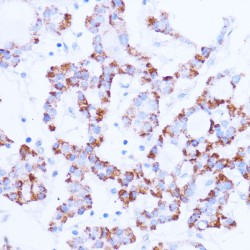 Sirtuin 3 (SIRT3) Antibody