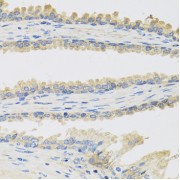 Immunohistochemistry analysis of paraffin-embedded Human prostate using INSL3 Antibody at dilution of 1/100 (40x lens). Microwave antigen retrieval performed in 0.01 M PBS Buffer (pH 7.2) prior to IHC staining.