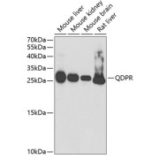 Western blot analysis of various lysates using QDPR Antibody at 1/1000 dilution. Secondary antibody: HRP-conjugated Goat anti-Rabbit IgG (H+L) at 1/10000 dilution. Lysates/proteins: 25 µg per lane. Blocking buffer: 3% nonfat dry milk in TBST. Exposure time: 90s.