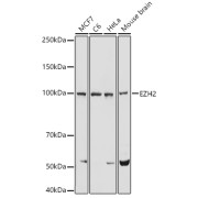 Western blot analysis of various lysates using EZH2/KMT6 Antibody at 1/1000 dilution. Secondary antibody: HRP-conjugated Goat anti-Rabbit IgG (H+L) at 1/10000 dilution. Lysates/proteins: 25 µg per lane. Blocking buffer: 3% nonfat dry milk in TBST. Exposure time: 5s.