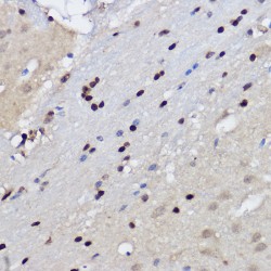 Histone-Lysine N-Methyltransferase EZH2 (EZH2) Antibody