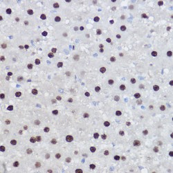Histone-Lysine N-Methyltransferase EZH2 (EZH2) Antibody