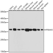 Western blot analysis of various lysates using PSMA5 Antibody at 1/1000 dilution. Secondary antibody: HRP-conjugated Goat anti-Rabbit IgG (H+L) at 1/10000 dilution. Lysates/proteins: 25 µg per lane. Blocking buffer: 3% nonfat dry milk in TBST. Exposure time: 180s.