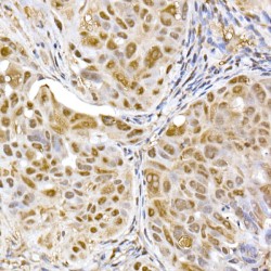Proteasome Subunit Alpha Type 5 (PSMA5) Antibody