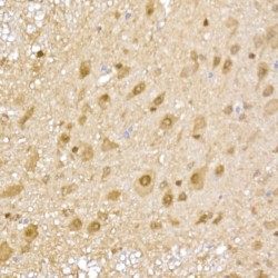 Proteasome Subunit Alpha Type 5 (PSMA5) Antibody