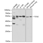 Western blot analysis of various lysates using TCN2 Antibody at 1/1000 dilution. Secondary antibody: HRP-conjugated Goat anti-Rabbit IgG (H+L) at 1/10000 dilution. Lysates/proteins: 25 µg per lane. Blocking buffer: 3% nonfat dry milk in TBST. Exposure time: 30s.