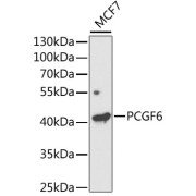 Western blot analysis of lysates from MCF7 cells, using PCGF6 Antibody at 1/1000 dilution. Secondary antibody: HRP-conjugated Goat anti-Rabbit IgG (H+L) at 1/10000 dilution. Lysates/proteins: 25 µg per lane. Blocking buffer: 3% nonfat dry milk in TBST. Exposure time: 120s.