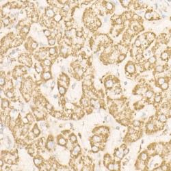 ATP Synthase Subunit Beta, Mitochondrial (ATP5F1B) Antibody