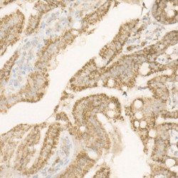 ATP Synthase Subunit Beta, Mitochondrial (ATP5F1B) Antibody