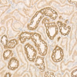 ATP Synthase Subunit Beta, Mitochondrial (ATP5F1B) Antibody