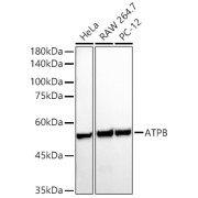 WB analysis of HeLa, RAW 264.7 and PC-12 cell lysates (25 μg/lane) using ATPB Antibody (1/25000 dilution) with <a href="https://www.abbexa.com/index.php?route=product/search&search=abx005548" target="_blank">abx005548</a> - Goat anti-Rabbit IgG H+L antibody conjugated to HRP (1/10000 dilution).