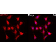 Western blot analysis of various lysates using GSTO2 Antibody at 1/900 dilution. Secondary antibody: HRP-conjugated Goat anti-Rabbit IgG (H+L) at 1/10000 dilution. Lysates/proteins: 25 µg per lane. Blocking buffer: 3% nonfat dry milk in TBST. Negative control (NC): MOLT-4. Exposure time: 90s.